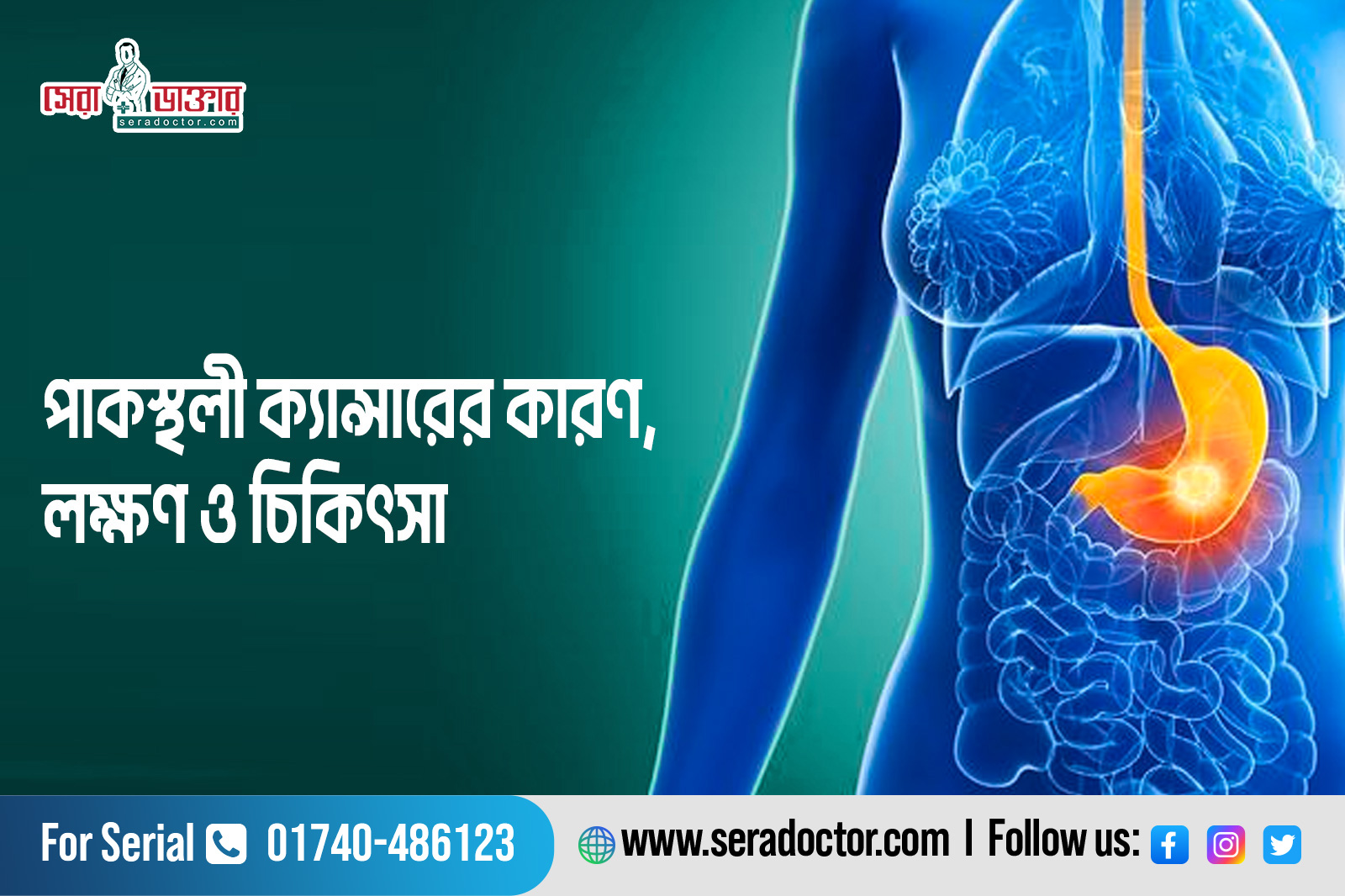 পাকস্থলী ক্যান্সারের কারণ, লক্ষণ ও চিকিৎসা